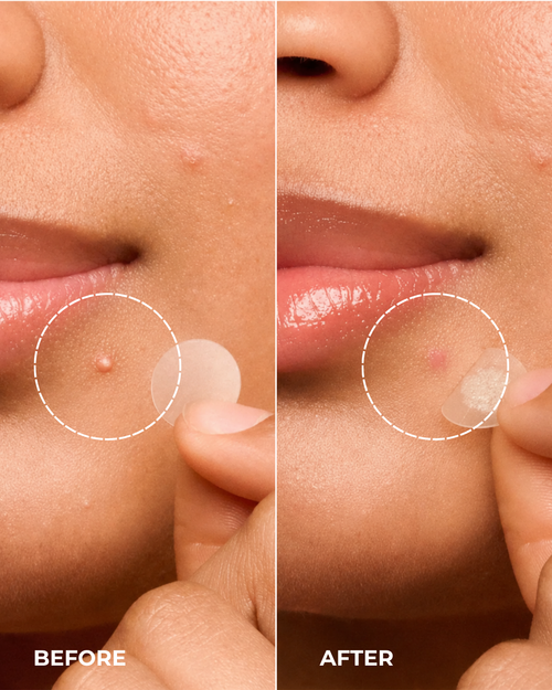 Solayre Collagen V-Line Lifting Mask
